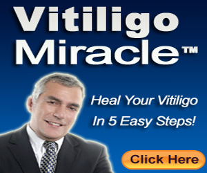 Vitiligo Miracle